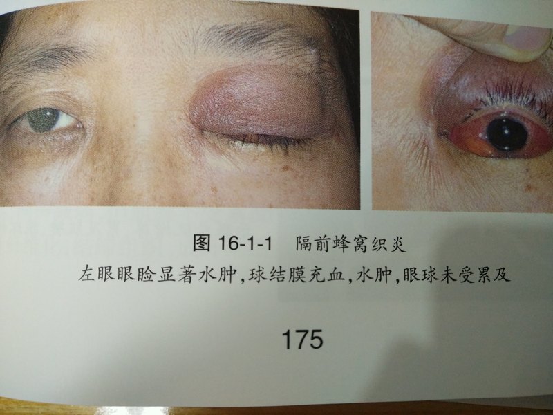 圖文圖片