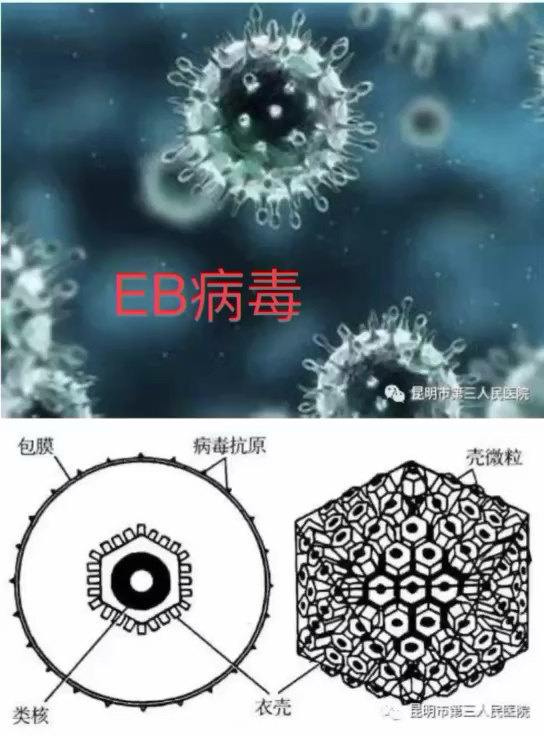 什么是EB病毒