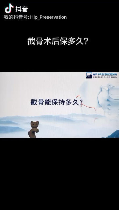 截骨术后可以保多久？