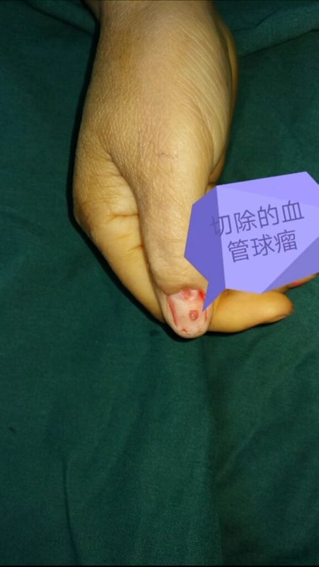 視頻封面