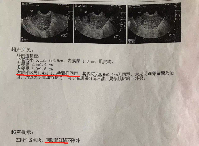 圖文圖片