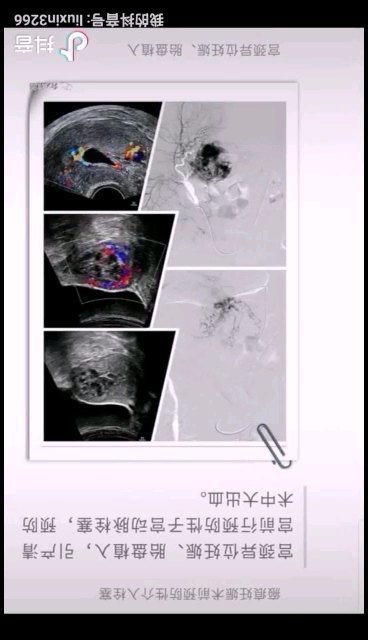 視頻封面
