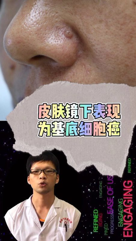 科普皮肤镜。