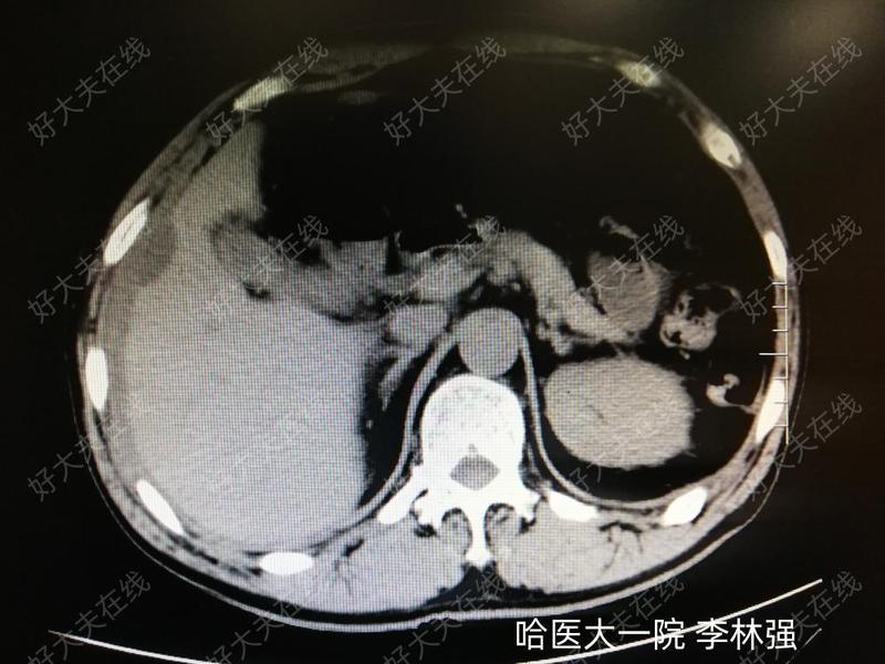圖文圖片
