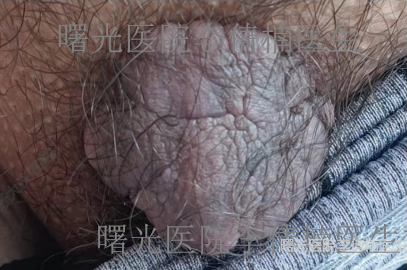 圖文圖片