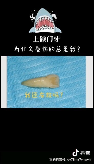 牙齿遭受意外伤害，如何做好应急处理，才能挽救一颗掉落的牙齿？