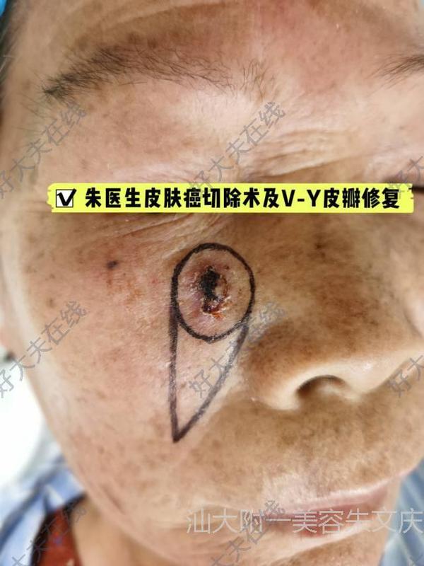 圖文圖片