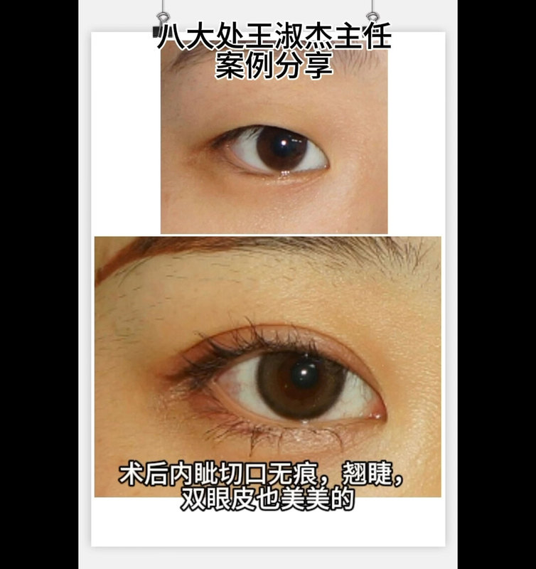 視頻封面