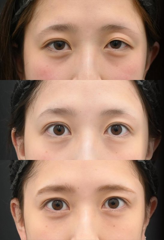 圖文圖片