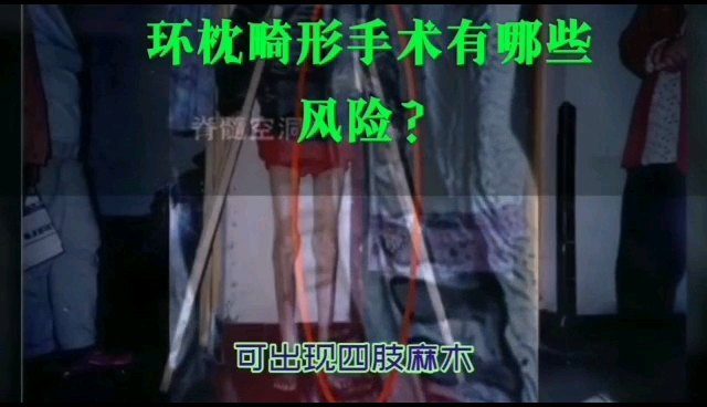 环枕畸形手术有哪些风险？
