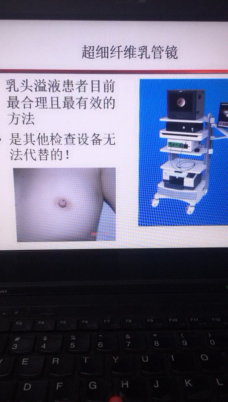 乳管镜的优势有哪些？
