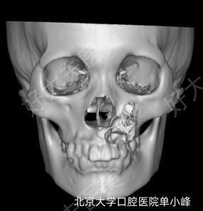 圖文圖片