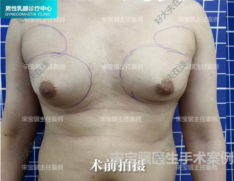 圖文圖片